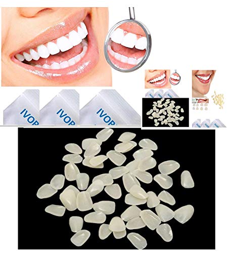 IVORIE Kozmetik Ultra İnce Beyazlatma Kaplamalar Reçine Diş Anterior 50 ADET (Gölge A2 Üst)